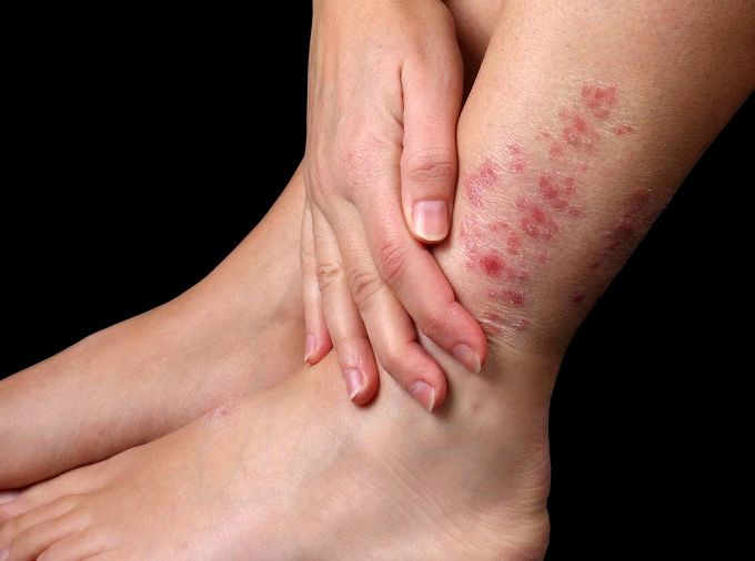 Причины неприятного запаха из-под ногтей на ногах