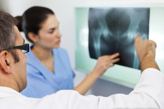 Целесообразность проведения рентгена тазобедренного сустава