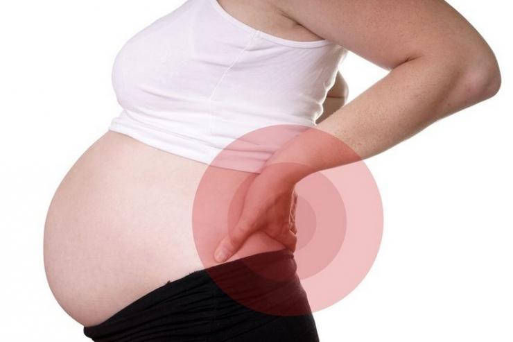 Действия при защемлении седалищного нерва у беременной женщины