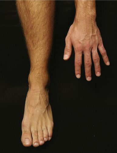 Топографическая анатомия ног
