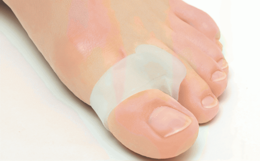 Виды корректоров для косточки большого пальца ноги