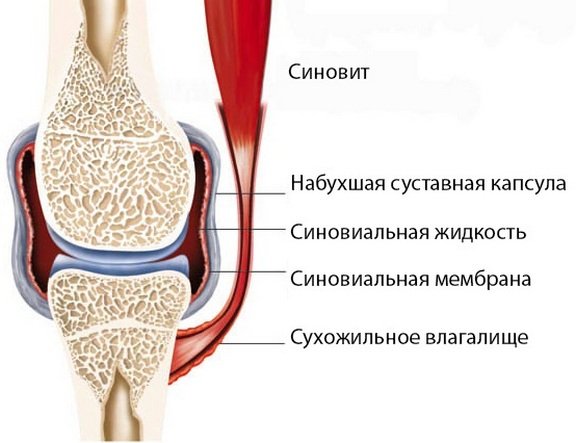 Причины боли в коленном суставе различного характера