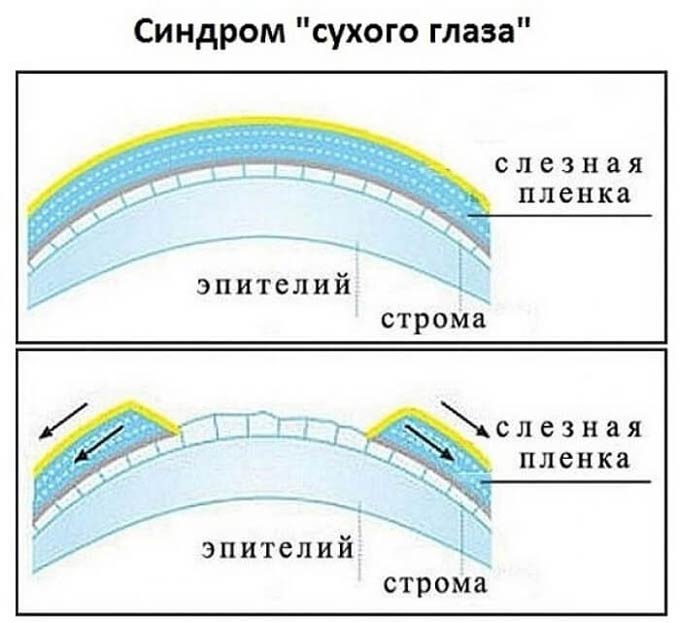 слезная пленка