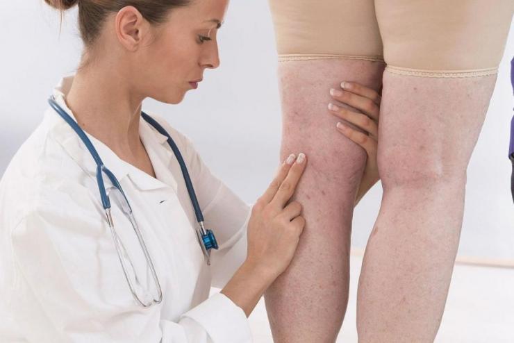 К какому врачу обратиться когда болят ноги?