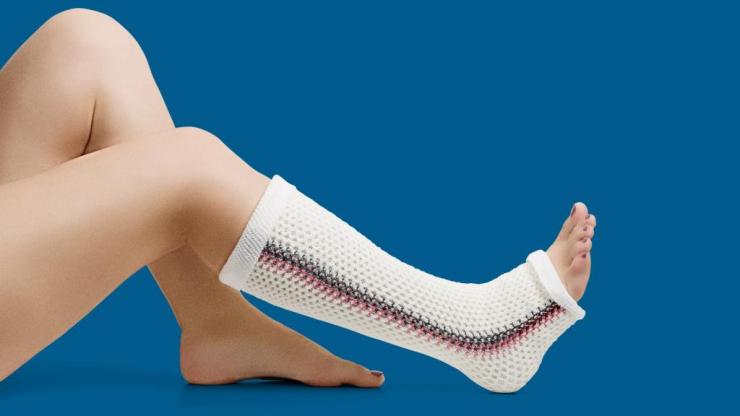 Альтернатива гипсу при переломе ноги - пластиковый ортез