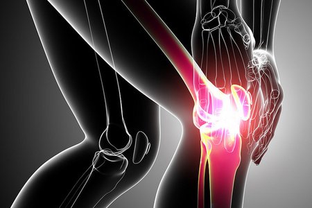Диагностика и лечение периартрита колена