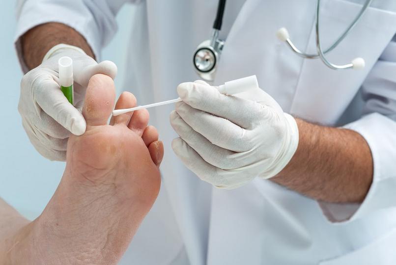 Действенные методы лечения вросшего ногтя на ноге