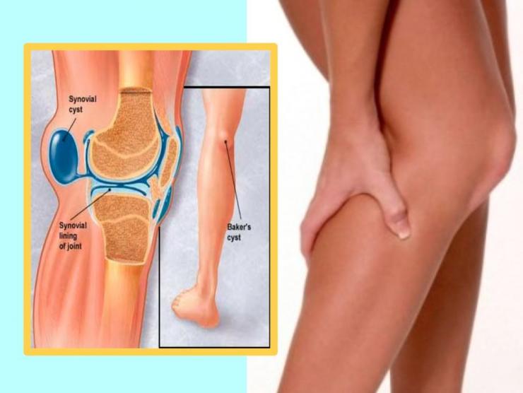 Причины боли под коленом сзади