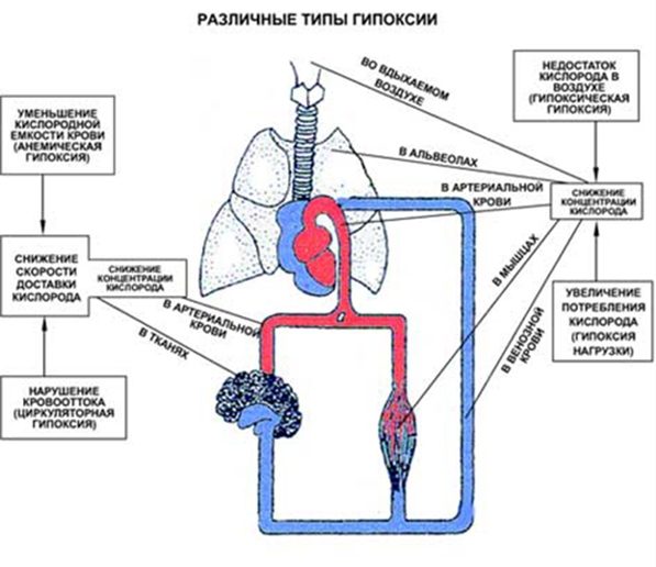 Различные типы гипоксии