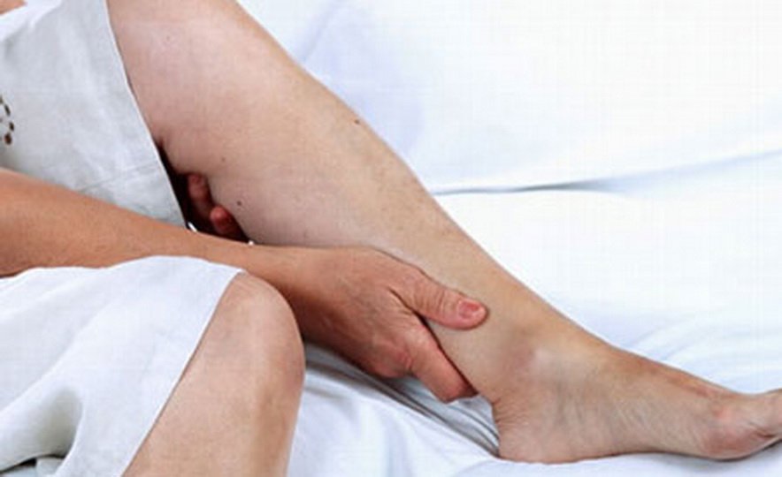Облитерирующий атеросклероз сосудов ног