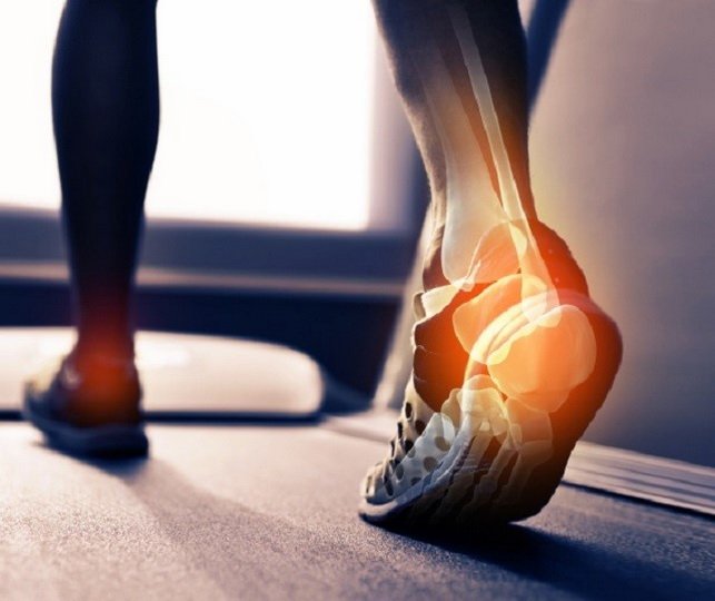 Симптомы и лечение артрита ног