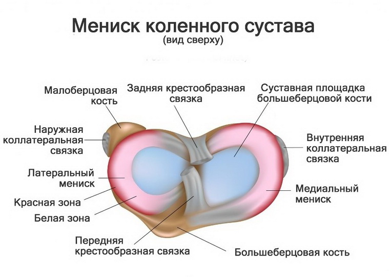 Разрыв мениска, растяжение связок коленного сустава: коды МКБ-10