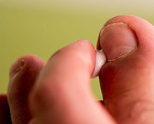 Виды и способы лечения грибка ногтей ног