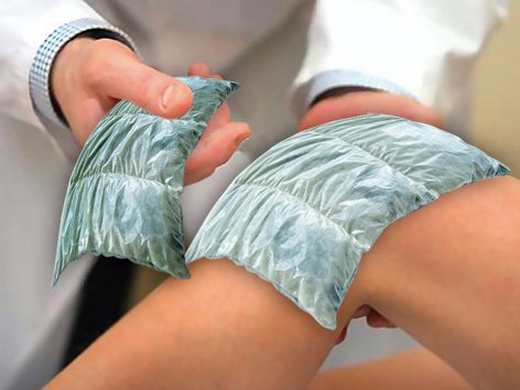 Народная медицина в лечении артрита коленного сустава