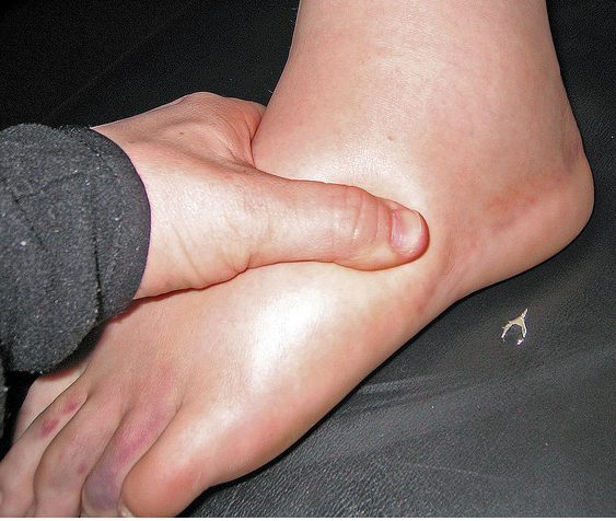 Причины и лечение отечности ног у мужчин