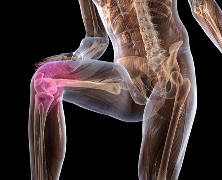 Проявления и методы лечения остеохондроза коленного сустава