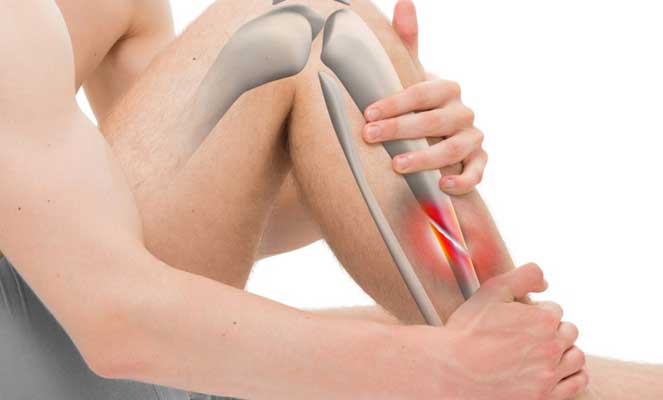 Восстановление после перелома ноги при помощи массажа