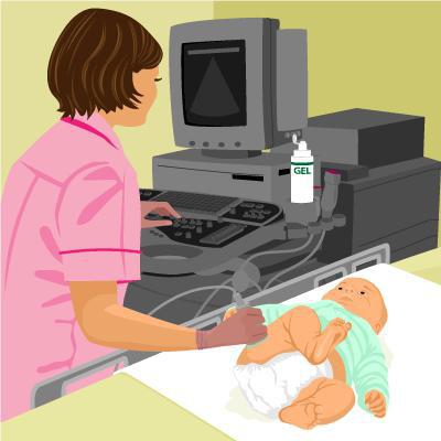 Физиологическая незрелость тазобедренных суставов у новорожденных