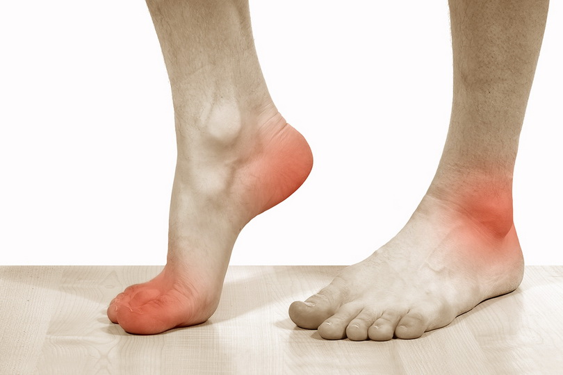 Что делать при болях в ступне ног во время ходьбы