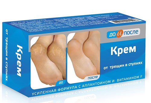 Критерии выбора охлаждающего крема для ног