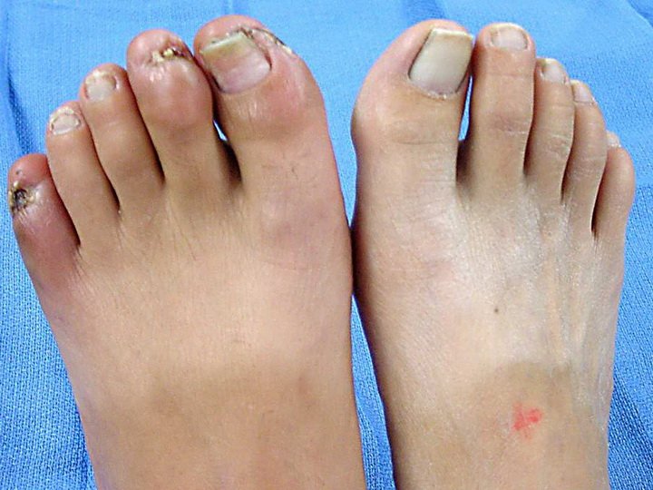 Названия и функции пальцев на ноге