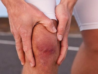 Восстановление коленного сустава после травмы