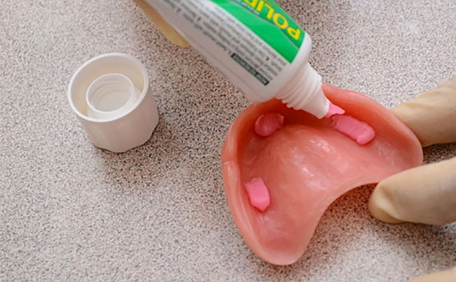 Фиксация зубного протеза с помощью крема