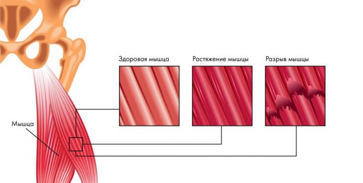 Анатомия мышц, управляющих стопой