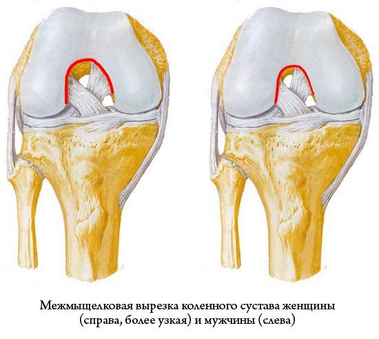 Разрыв связок коленного сустава симптомы фото