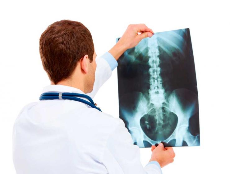 Лечение и последствия перелома седалищной кости