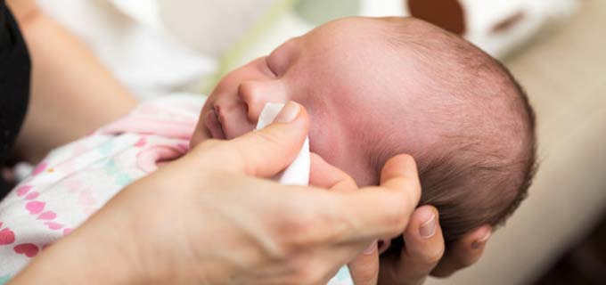 непроходимость слезного канала у новорожденных