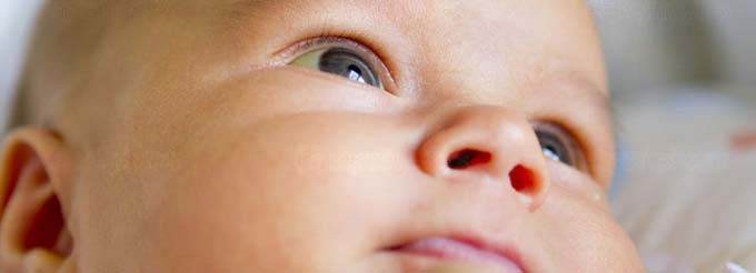 желтые белки глаз у новорожденных
