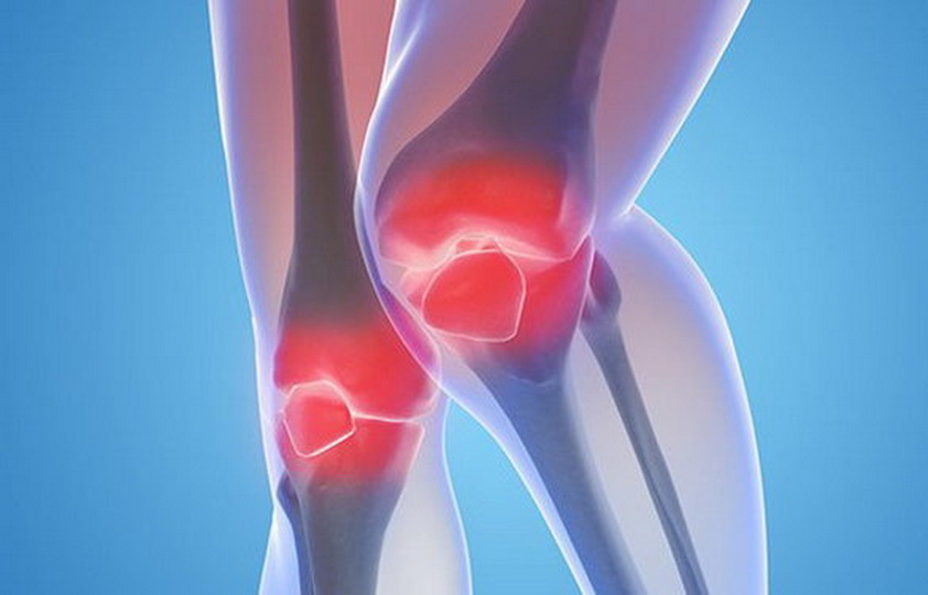 Способы лечения деформирующего артроза колена 3 стадии