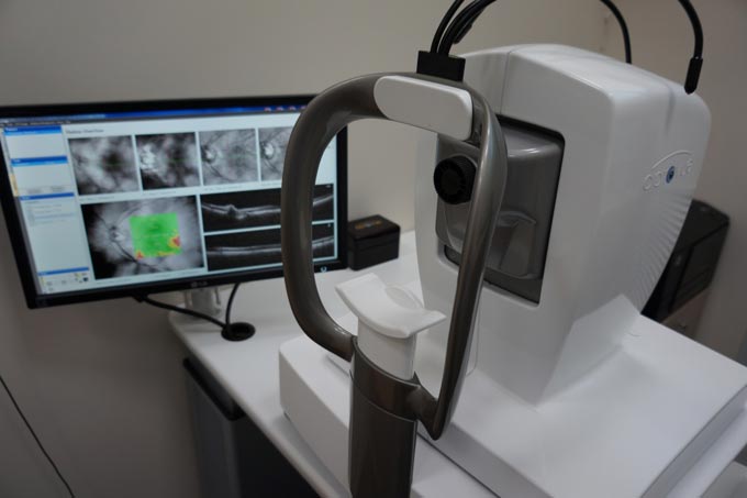 оптический когерентный томограф