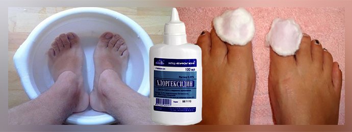 Использование Хлоргексидина при лечении грибка ногтей