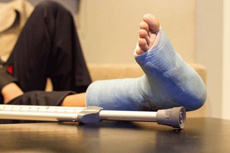 Как снять отек ноги после перелома?